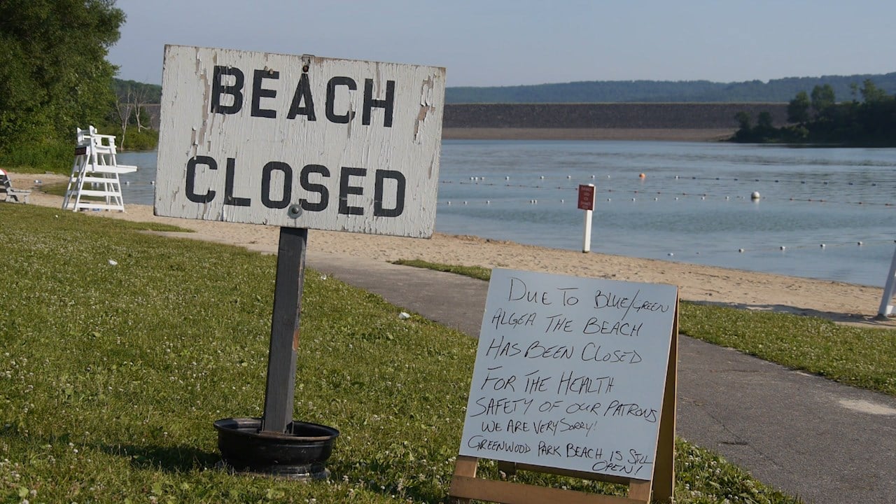 Dorchester Park Beach Closed Due To Algae Bloom - WICZ